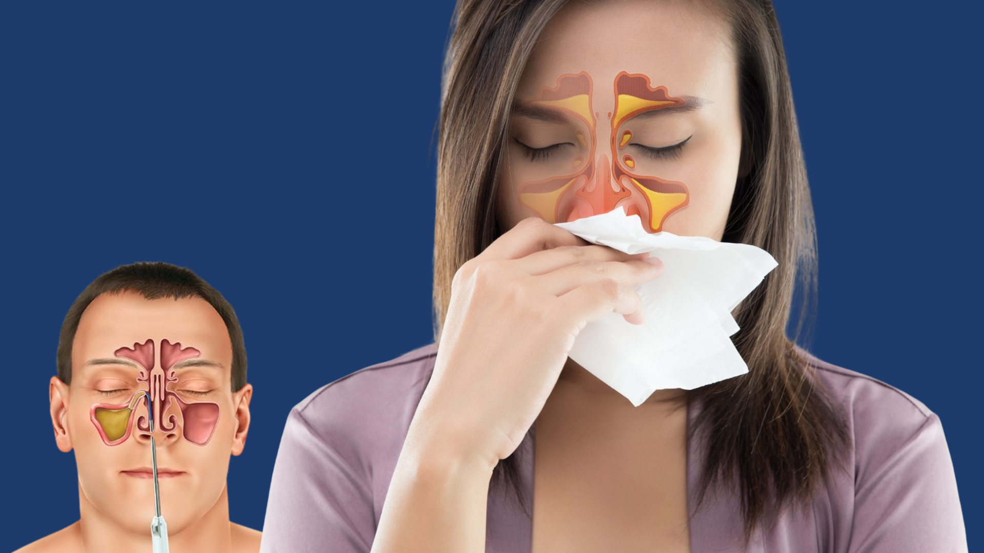 Functional Endoscopic Sinus Surgery (FESS) – Chronic Sinusitis Treatment