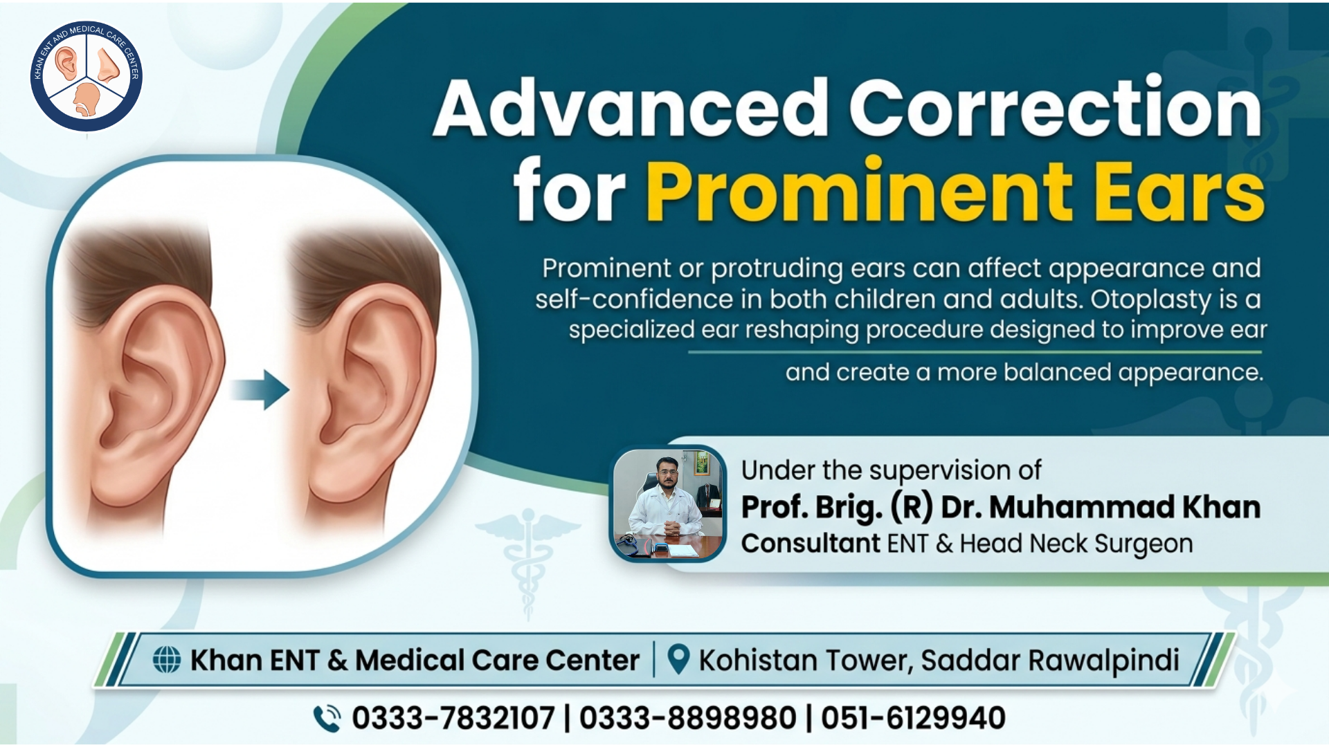Otoplasty in Rawalpindi for Prominent Ear Correction (1) Otoplasty in Rawalpindi for Prominent Ear Correction