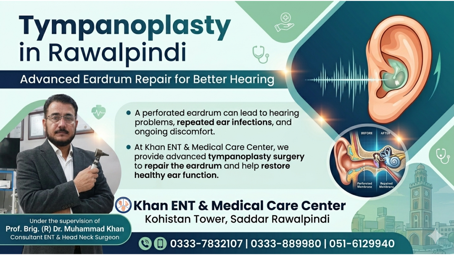 Tympanoplasty in Rawalpindi for Eardrum Repair Tympanoplasty in Rawalpindi for Eardrum Repair